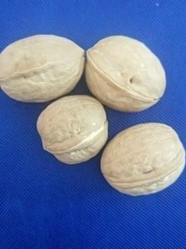 7个小偏方有效治痔疮